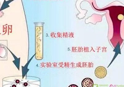 俄罗斯做第三代试管婴儿需要多长时间？花费是多少？